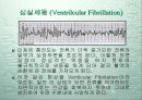 세동제거기 5페이지