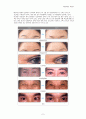 보톡스 (Clostridium botulinum Toxin A) 6페이지