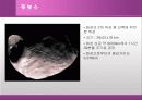 화성에 관한 발표 자료 33페이지