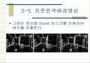 획득 영상에서의 물체인식 및 추적 25페이지