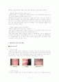 알레르기(Allergy)에 대해 7페이지