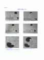 응급처치 심폐소생술 화상 기도폐쇄 코피 6페이지