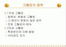 고혈압(hypertension) PPT 발표자료  5페이지