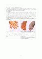 퇴행성 관절염 (degenerative arthritis)과 류마티스 관절염 (rheumatoid arthritis) 5페이지