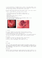 위암 케이스 고찰 2페이지