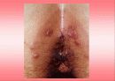 성병에 대하여… 15페이지