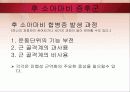 소아마비 파워포인트 16페이지