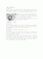  Hydrocephalus ; 수두증 - 문헌고찰 3페이지