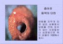 흡연과 알코올의 피해 14페이지