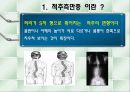 척추측만증 파워포인트 3페이지