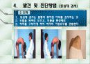 척추측만증 파워포인트 7페이지