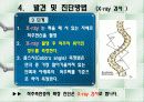 척추측만증 파워포인트 8페이지