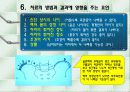 척추측만증 파워포인트 10페이지