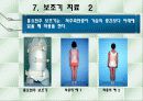 척추측만증 파워포인트 12페이지