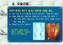 척추측만증 파워포인트 14페이지