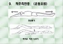 척추측만증 파워포인트 16페이지