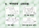 척추측만증 파워포인트 19페이지