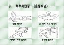 척추측만증 파워포인트 20페이지