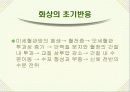 화상환자간호 파워포인트 12페이지