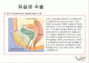 방광재활과 요실금 46페이지