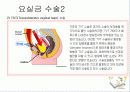 방광재활과 요실금 47페이지