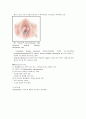 [독후감/서평/요약] 요실금(Urinary Incontinence) 7페이지