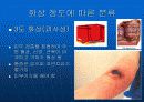 화상과 응급처치 13페이지