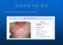 화상과 응급처치 26페이지