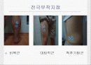 편측 시야 차단이 자세조절근에 미치는 영향 9페이지