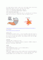 [성인]위암 질병보고서 5페이지