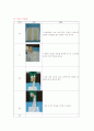 수술실 경막하 혈종 케이스 스터디 12페이지