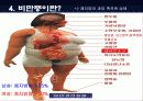 섭식장애 설명 파워포인트 18페이지