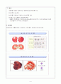 신우신염 case study -급성 신우신염, 정의,빈도, 간호력, 진단검사 5페이지