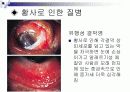 황사에 대한 보건교육 ppt 8페이지