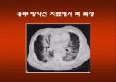 방사선 치료 합병증 관리 21페이지
