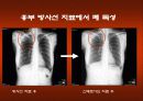 방사선 치료 합병증 관리 24페이지