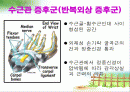 수근관증후군에 관한 자료입니다. 2페이지