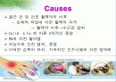 수근관증후군에 관한 자료입니다. 4페이지