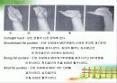 수근관증후군에 관한 자료입니다. 18페이지