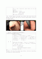 UGI Bleeding 대상자 Case study 10페이지