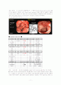 UGI Bleeding 대상자 Case study 11페이지