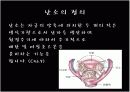 Ovariancancer 난소암 3페이지