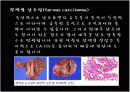 Ovariancancer 난소암 16페이지