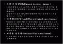 Ovariancancer 난소암 20페이지