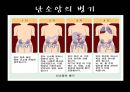 Ovariancancer 난소암 21페이지