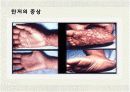 동물매개 전염병 10페이지