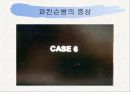 신경계와 파키스병 29페이지