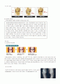 인공관절치환술 case study(TKR) 2페이지