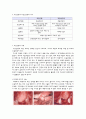 자궁근종 케이스-myoma uteri case study 12페이지