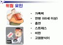 [고혈압]노인교육자료 파워포인트입니다. 3페이지